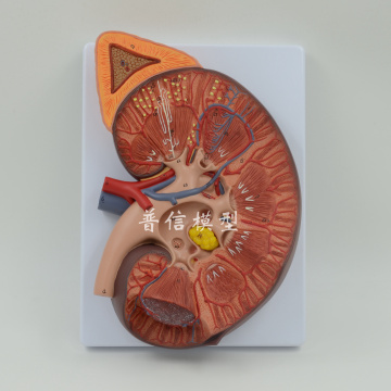 Kidney Anatomical Model Urinary System Medical Science Teaching Supplies