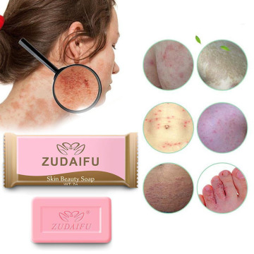 1/2PCS 7g Sulfur Soap Skin Conditions Acne Psoriasis Seborrhea Eczema Anti Fungus Bath Whitening Soap Shampoo dropship TSLM1