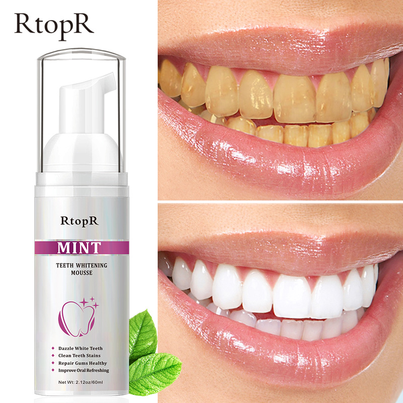 Teeth Cleansing Whitening Mousse Removes Stains Yellow Teeth Whitening Oral Hygiene Mousse Toothpaste Dental Whitening Staining