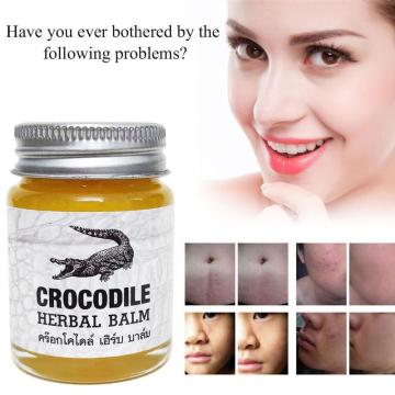 Crocodile Scar Removal Cream Thailand Herbal Balm Whitening Face Cream Stretch Marks Acne Scar Remover Pigmentation Corrector