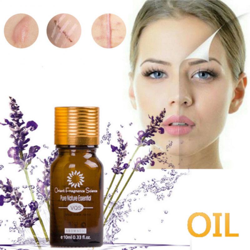 Ultra Brightening Spotless Oil Skin Care Dark Spots Remove Ance Burn Strentch Marks Scar Removal Brightening Skin Essence Oil