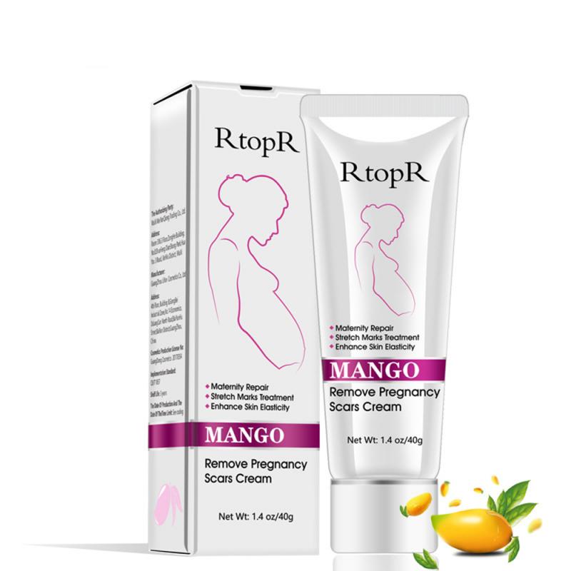 Mango Remove Pregnancy Acne Scar Stretch Mark Cream Treatment Maternal Anti-Aging Repair Anti-Wrinkle Firming Body Cream TSLM2
