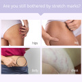 Natural Scar Repair Cream Postpartum Stretch Marks Acne Burn Pregnancy Scar Removal Smooth Body Skin Treatment&Care Products 20g