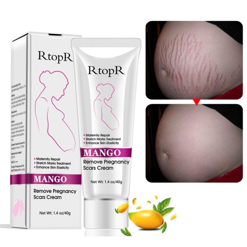 Mango Remove Pregnancy Acne Scar Stretch Mark Cream Treatment Maternal Anti-Aging Repair Anti-Wrinkle Firming Body Cream TSLM2