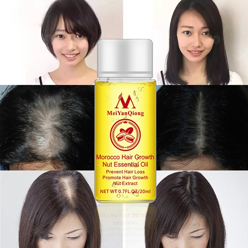 Natural Andrea Hair Growth Products Ginger Oil Hair Growth Faster Grow Hair Ginger Shampoo Stop Hair Loss Treatment