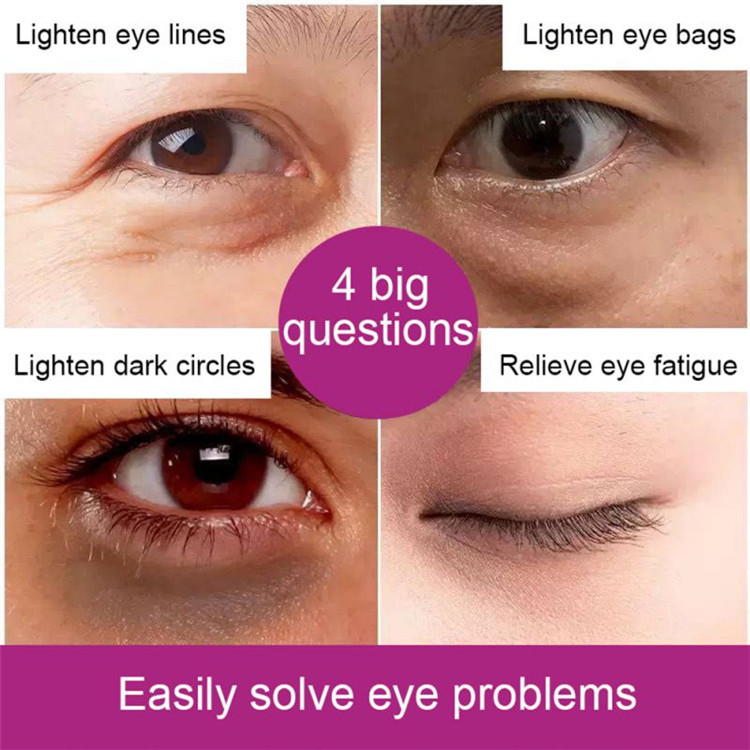 2 Minutes Instant Eye Bag Removal Cream Long Lasting Effect Puffiness Wrinkles Fine Lines Remove Eye Cream For Women Men TSLM2
