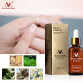 NEW!!!Fungal Nail Treatment Essence Nail and Foot Whitening Toe Nail Fungus Removal Feet Care Nail Gel Can Drop Shipping