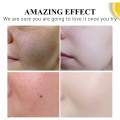 HEMEIEL Vitamin C Whitening Set Face Cream Facial Serum Spray Freckle Fade Spots Brighten Moisturizing Whitening Skin Care Sets