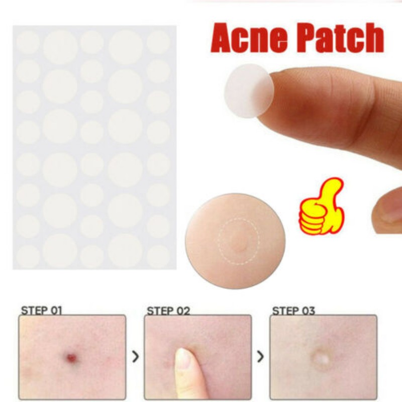 36pcs Acne Patch Set Invisible Pimple Skin Tag Remover Patch Blackhead Blemish Remover Sticker Acne Treatment Face Care