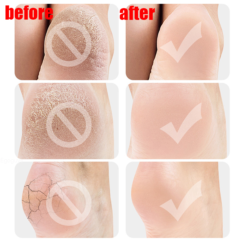 2Pcs New Silicone Feet Care Socks Moisturizing Gel Heel Thin Socks with Hole Cracked Foot Skin Care Protectors Foot Care Tool