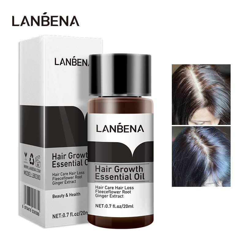 LANBENA Ginger Hair Growth Essential Oil Anti-hair Loss Nourish Hair Roots Consolidate Hair Loss Serum Hair Regeneration Product