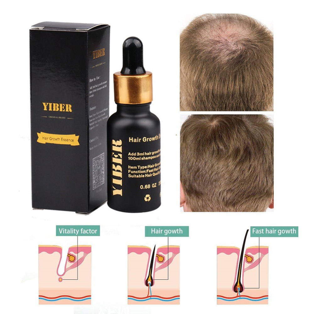 20ml Hair Growth Essential Oil Anti Hair Loss Product Natural Hair Regrowth Fast Thicker Treatment Preventing Baldness Hair Care