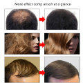 EFERO Hair Growth Essence Hair Loss Serum Essential Oils Dense Hair Growth Serum HairCare Prevent Baldness Anti-Hair Loss Serum