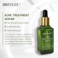 BREYLEE Acne Treatment Facial Essence Anti Acne Serum Scar Remover Cream Face Skin Care Whitening Repair Pimple Remover For Acne