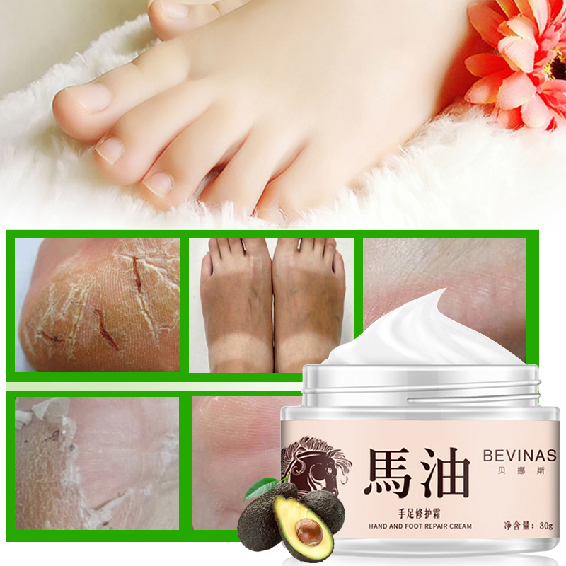 Horse Oil Anti Fungal Foot Cream Relieve Beriberi Anti Dry Crack Repair Moisturizing Feet Treatment Fungal Infection Skin Care