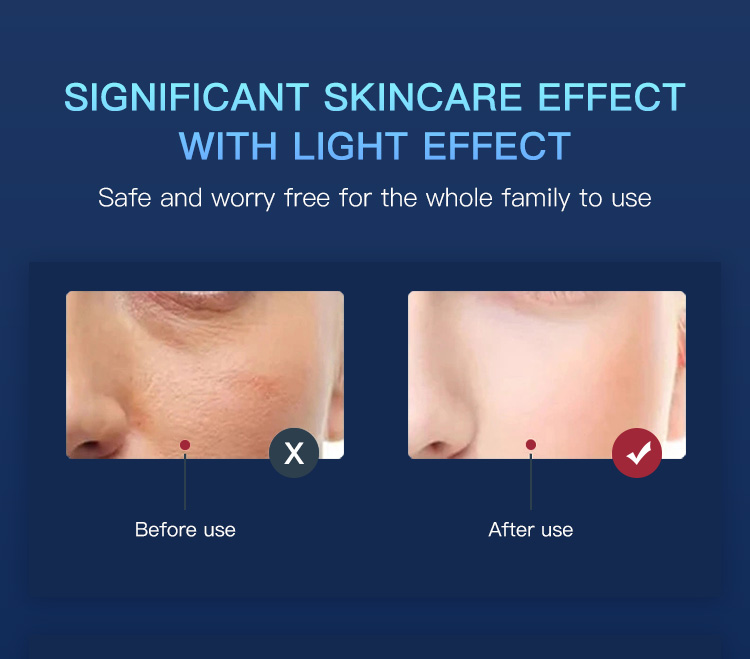 led treatment for face