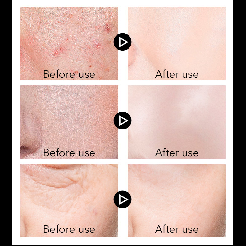 MANCODES 50g Men Moisturizing Face Cream Oil Control Night Cream Firming Hyaluronic Acid Whiten facial Serum Men Skin Care