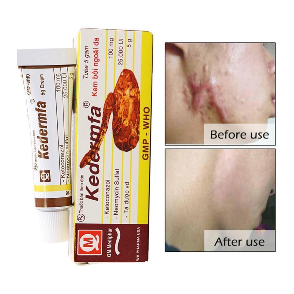 Vietnam Kedermfa 100% Original Snake Oil Hand Skin Face Care Cream Snake Balm Ointment 5g/Tube Nourishing Skin Moisture Body