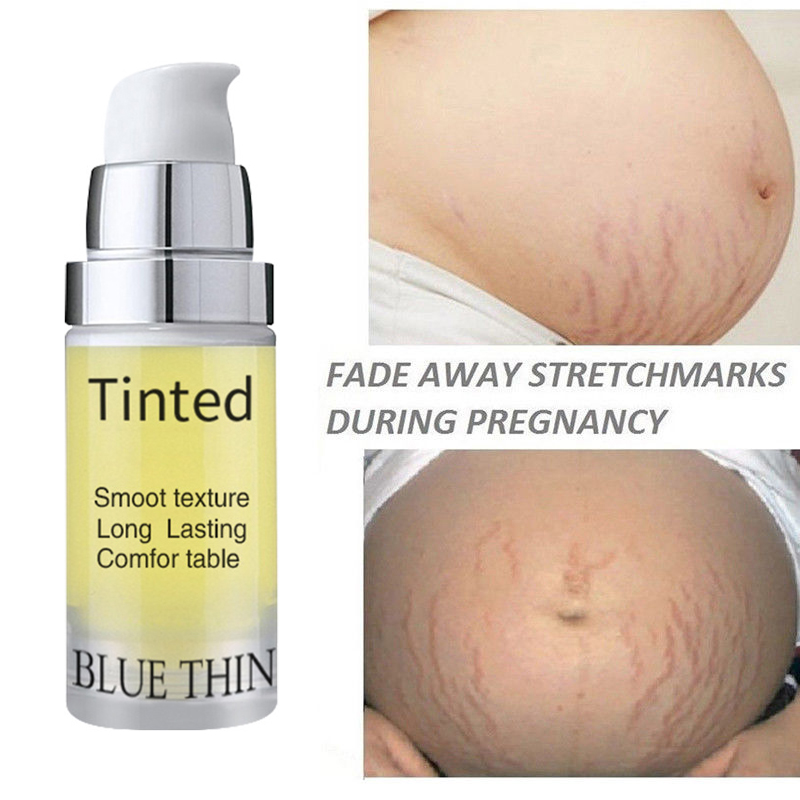 10ml Repair Cream Removal Fade Stretch Marks Scar Obesity Pattern Growth Pattern Gel Nourishing Maternity Body Skin Care TSLM1