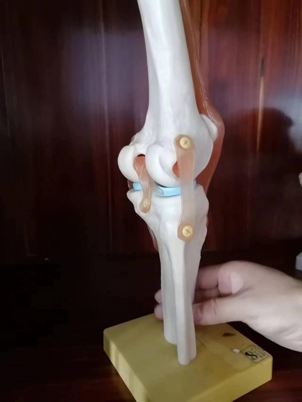 Life-Size Knee Joint Anatomy Model