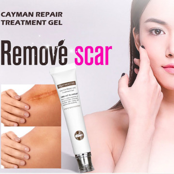 Cayman Serum Women Skin Scar Acne Estrias Mark Removal Gel Face Body Acne Postpartum Repair Crema Hidratante Facial Pimple Patch