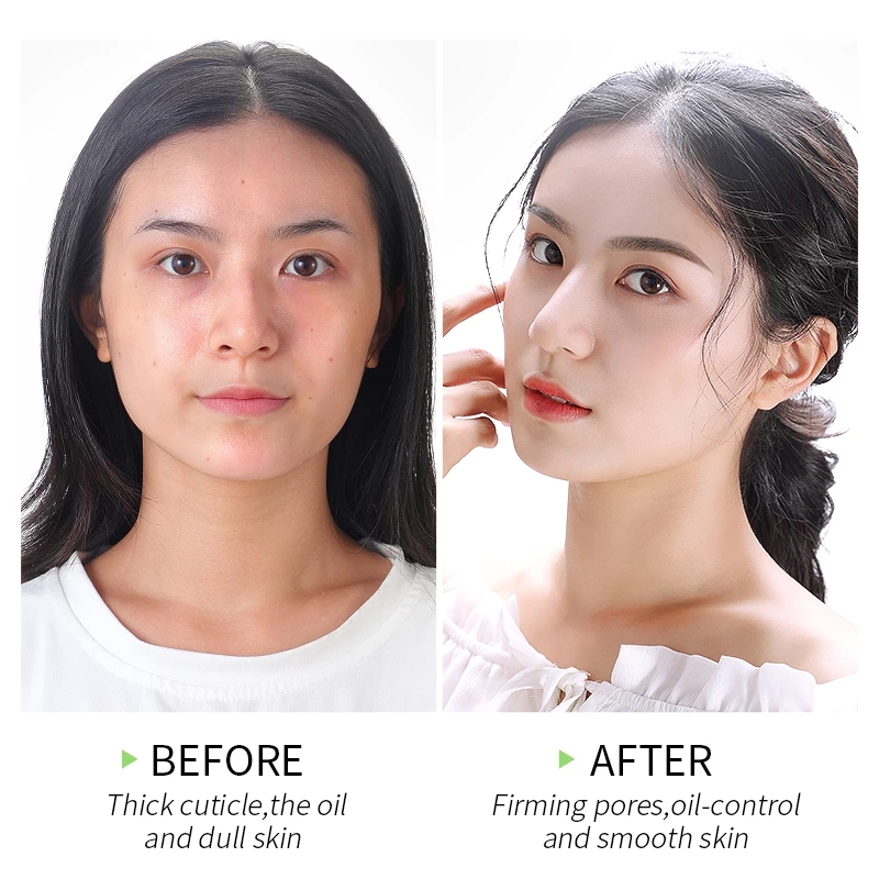 Fruit Acid Exfoliation Gel Soften keratin Peeling Facial Scrub Moisturizing Whitening Repair Skin Care Body Scrub 80g