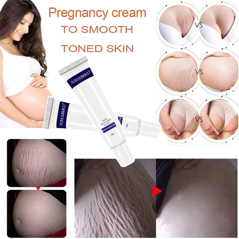 Natural Scar Repair Cream Postpartum Stretch Marks Acne Burn Pregnancy Scar Removal Smooth Body Skin Treatment&Care Products 20g