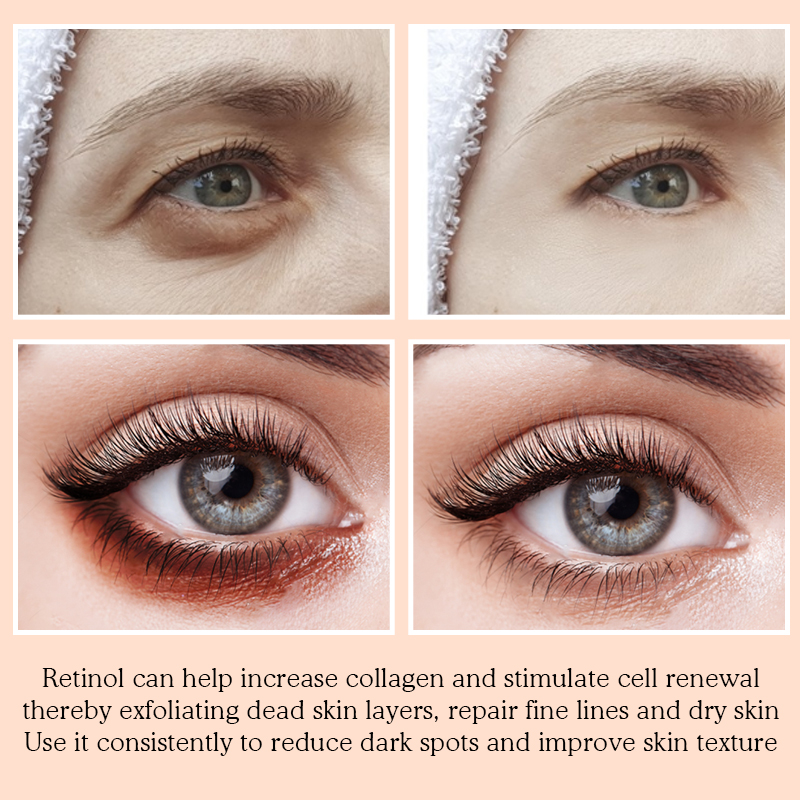 VIBRANT GLAMOUR Collagen Eye Patch Retinol Anti-Aging Remove Dark Circles Eye Bag Firming Moisturizing Anti-wrinkle Eye Mask
