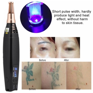Scar Tattoo Removal Laser Pen Freckle Acne Mole Dark Spot Pigment Tattoo Removal Beauty Machine Pro Repair Picosecond Pen Salon