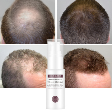 VIBRANTGLAMOUR Hair Growth Essence Liquid Prevent Hair Loss Essential Oil Nourish Roots Thick Anti-loss hair Use for hair Growth