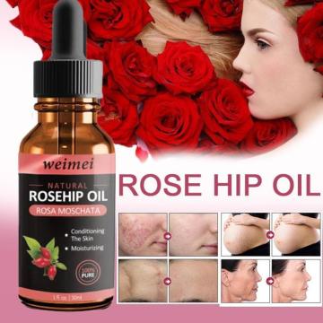 Organic Rosehip Seed Oil Moisturizing Brighten Skin Color Anti-Dry Anti-Aging Face Care Essential Oil