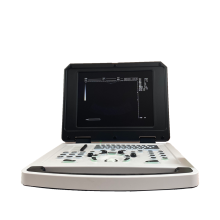Cheap and Competitive Notebook Laptop Ultrasound Scanner
