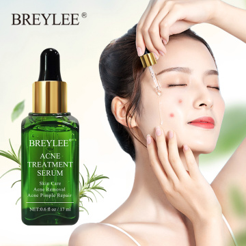 BREYLEE Acne Treatment Facial Essence Anti Acne Serum Scar Remover Cream Face Skin Care Whitening Repair Pimple Remover For Acne