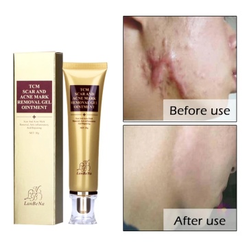 Removal Scar Cream Face Pimples Scar Stretch Marks Removal Acne Treatment Face Moisturizing Cream Skin Care Whitening Cream