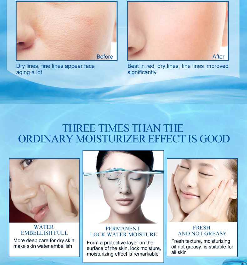 5pcs Super Serum Repair Emulsion Skin Care Moisturizing Ance Treatment Face Cream Lotion Whitening Effect Anti Aging Care