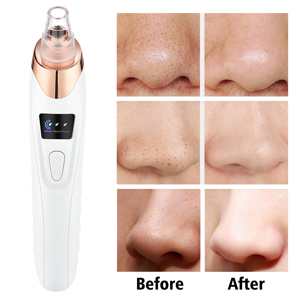 Electric Vacuum Blackhead Remover Suction Pore Cleaner Deep Cleansing Skin Care Tools Spot Acne Pimple Black Head Extractor