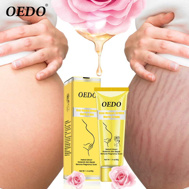 OEDO Scar Removal Cream Rose Remove Stretch Mark Cream Nourish Pregnant Women Skin Repair Remove Obesity Tattoo Body Care 40g