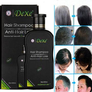 Dexe professional Shampoo for Hair regrowth Anti hair Loss Chinese Hair Growth Product Prevent Hair Treatment for Men & Women