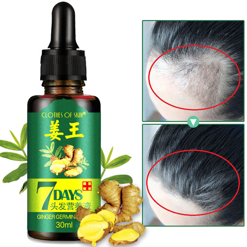 7 Day Ginger Germinal Serum Essence Oil Natural Hair Loss Treatement Effective Fast Growth Hair Care 30ML