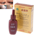 Body Warts Treatment Cream Skin Tag Remover Foot Corn Removal Plantar Genital Warts Ointment Foot Care Cream 12ml