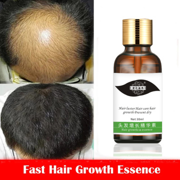 Fast Hair Growth Essence Hair Loss Products Hair Growth Fibras Cabelo Shampoo Cremes De Tratamento Para Cabelos Hair Care