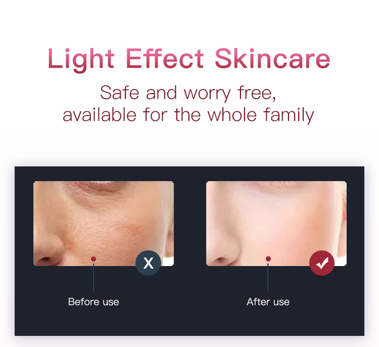 wrinkle removal