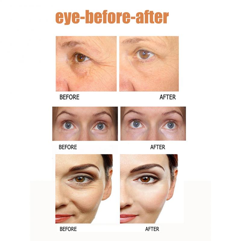 1PC Eye Care Remove Dark Circles Fine Lines Eye Bag Against Aging Removal Deep Moisturizing Eye Cream For Women And Men TSLM2