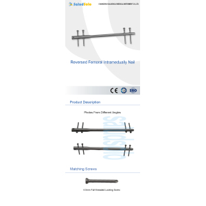 Reversed Femoral Nail Medical