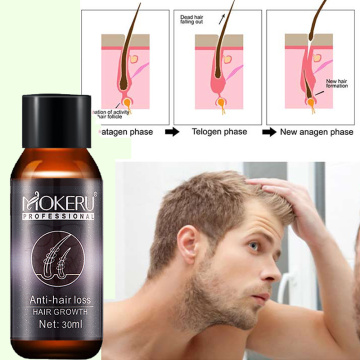 1pc 30ml Mokeru Natural organic castor oil tonic essence hair loss products growth oil for hair growth treatment