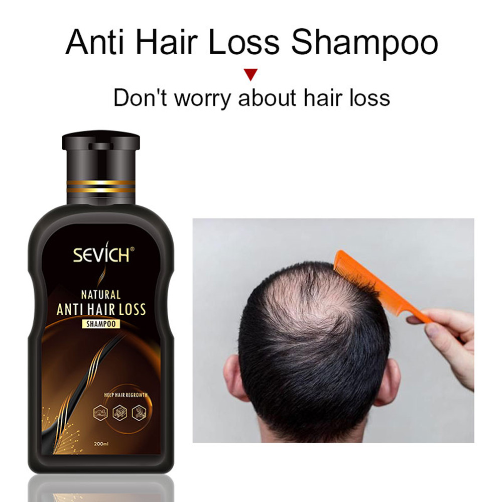 Sevich 200ml Anti Hair Loss Shampoo Ginger Hair Growth Shampoo for Hair Professional Shampoo Bar Hair Loss Treatment Hair Care