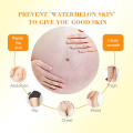 Collagen Remove Pregnancy Scars Acne Cream Stretch Marks Treatment Maternity Repair Anti-Aging Anti-Winkles Firming Body Creams