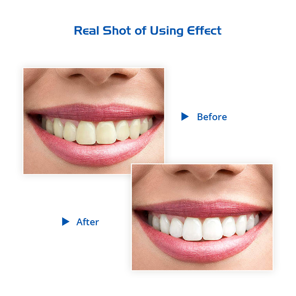 Activated Charcoal Teeth Whitening Strips with Led Light Accelerator Teeth Whitening Kit for Home Use