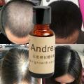 Rapid hair growth oil alopecia ginger loss senbast jade 20 ml natural organic growth treatment