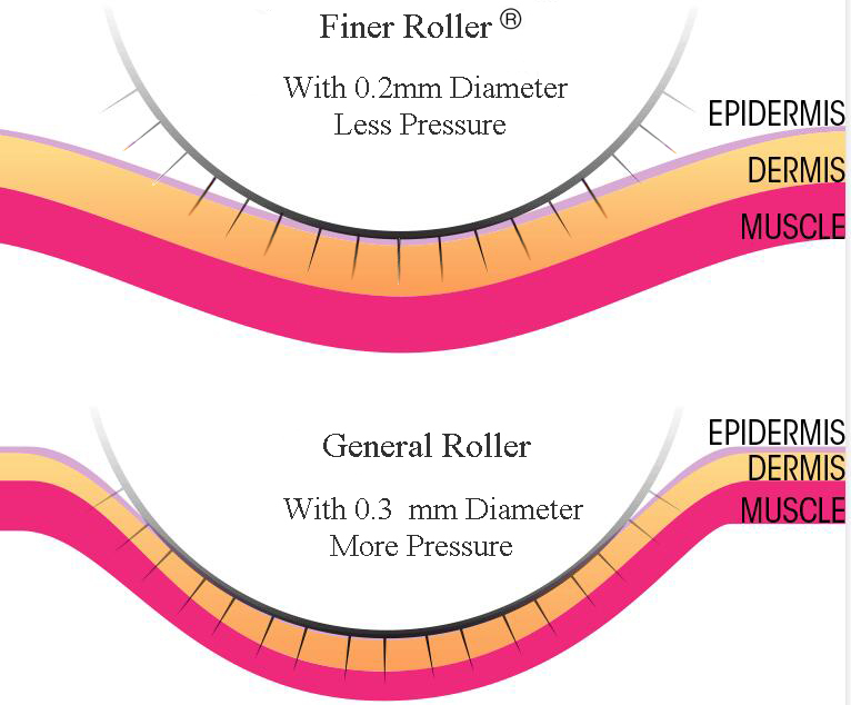 finer roller pressure